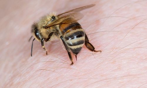 Một số mẹo dân gian sơ cứu khi bị ong đốt tại chỗ cực hiệu quả