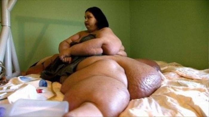 Người phụ nữ nặng gần 500kg ‘lột xác’ ngoạn mục
