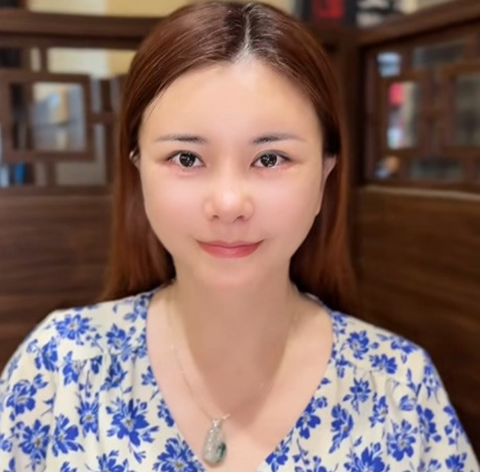 Không nhận ra diễn viên Kim Oanh hậu sang Hàn trùng tu toàn bộ gương mặt